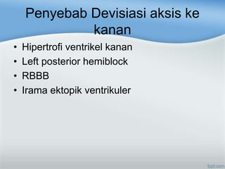 Penyebab Devisiasi aksis ke
kanan
• Hipertrofi ventrikel kanan
• Left posterior hemiblock
• RBBB
• Irama ektopik ventrikuler