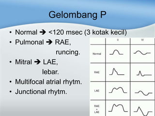 Gelombang P
• Normal <120 msec (3 kotak kecil)
• Pulmonal RAE,
runcing.
• Mitral LAE,
lebar.
• Multifocal atrial rhytm.
• Junctional rhytm.