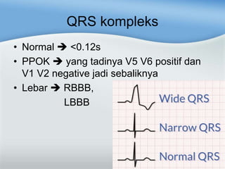 QRS kompleks
• Normal <0.12s
• PPOK yang tadinya V5 V6 positif dan
V1 V2 negative jadi sebaliknya
• Lebar RBBB,
LBBB