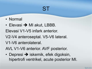 ST
• Normal
• Elevasi MI akut, LBBB.
Elevasi V1-V5 infark anterior.
V2-V4 anteroseptal. V5-V6 lateral.
V1-V6 anterolateral.
AVL V1-V6 anterior. AVF posterior.
• Depresi iskemik, efek digoksin,
hipertrofi ventrikel, acute posterior MI.