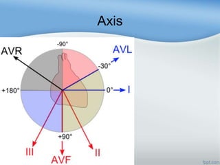 Axis