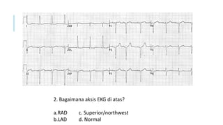 Rad Ecg Example EKG Dasar untukDokter umum dan tenaga kesehatan .pdf