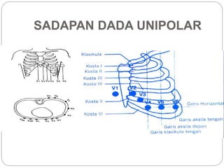 SADAPAN DADA UNIPOLAR
 