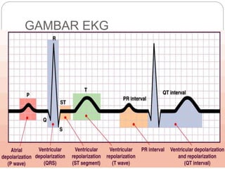 GAMBAR EKG
 