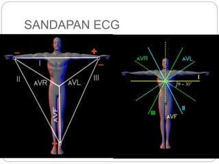 SANDAPAN ECG
 