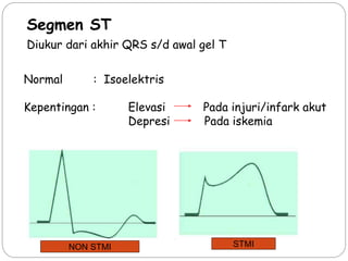 Normal : Isoelektris
Kepentingan : Elevasi Pada injuri/infark akut
Depresi Pada iskemia
Segmen ST
Diukur dari akhir QRS s/d awal gel T
NON STMI STMI
 