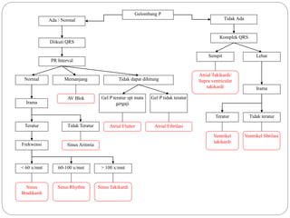 Gelombang P
Ada / Normal Tidak Ada
Diikuti QRS
PR Interval
Tidak dapat dihitung
Memanjang
Gel P teratur spt mata
gergaji
Normal
Gel P tidak teratur
Tidak Teratur
Frekwensi
Teratur
< 60 x/mnt 60-100 x/mnt > 100 x/mnt
Sinus Rhythm Sinus Takikardi
Sinus Aritmia
Atrial Flutter
Sinus
Bradikardi
Atrial Fibrilasi
AV Blok
Atrial Takikardi/
Supra ventricular
takikardi
Ventrikel
takikardi
Sempit Lebar
Komplek QRS
Teratur
Irama
Tidak teratur
Irama
Ventrikel fibrilasi
 
