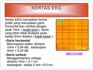KERTAS EKG
Kertas EKG merupakan kertas
grafik yang merupakan garis
horizontal dan vertikal dengan
jarak 1mm ( kotak kecil ). Garis
yang lebih tebal terdapat pada
setiap 5mm disebut ( kotak besar ).
Garis horizontal
Menunjukan waktu, dimana
1mm = 0,04 dtk, sedangkan
5mm = 0,20 dtk.
Garis vertical
Menggambarkan voltage,
dimana 1mm = 0,1 mv ,
sedangkan setiap 5 mm =0,5 mv.
ISMAIL PRODUCTION
0,04 dt
0, 20 dt
0,1 mv 0,5 mv
 