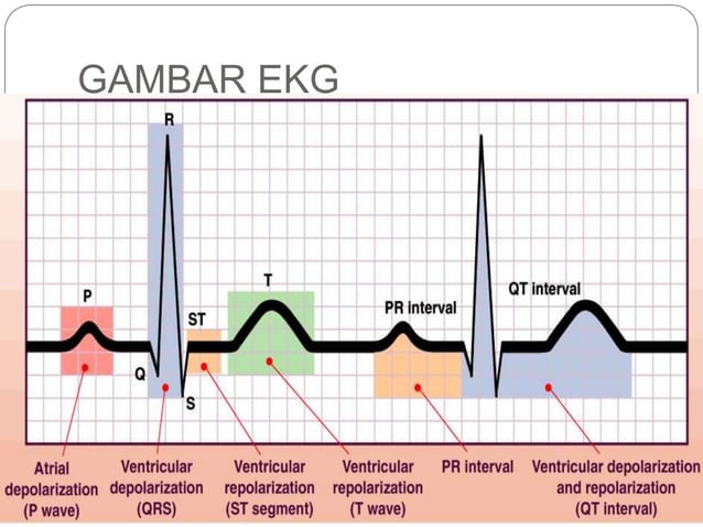 EKG_Dasar_dan_Cara_Interpretasi.pptx