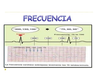 Ekg De Arritmias Supraventriculares Pdf Ekg De Arritmias Supraventriculares Pdf