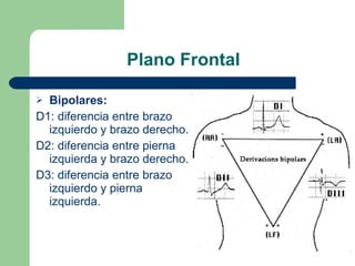 Plano Frontal Bipolares:   D1: diferencia entre brazo izquierdo y brazo derecho. D2: diferencia entre pierna izquierda y brazo derecho. D3: diferencia entre brazo izquierdo y pierna izquierda. 
