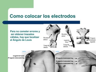Como colocar los electrodos  Para no cometer errores y así obtener trazados válidos, hay que localizar  el Ángulo de Louis 