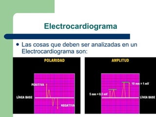 Electrocardiograma Las cosas que deben ser analizadas en un Electrocardiograma son:  