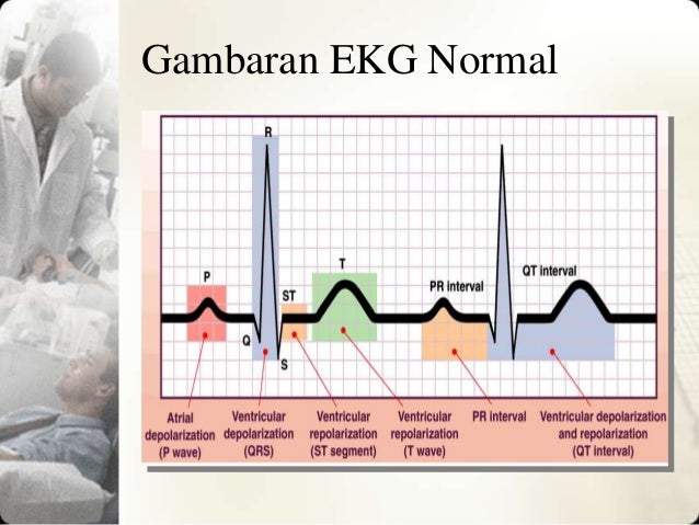 Gambar Ekg Dr Anjang Kertas Ecg 10 Gambaran Normal Gambar Jantung di ...