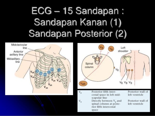 Cara Ekg