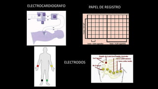 ELECTROCARDIOGRAFO PAPEL DE REGISTRO
ELECTRODOS
 