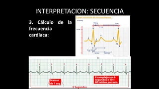 INTERPRETACION: SECUENCIA
3. Cálculo de la
frecuencia
cardiaca:
 