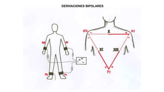 DERIVACIONES BIPOLARES
 