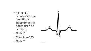 • En un ECG
característico se
identifican
claramente tres
ondas del ciclo
cardiaco.
• Onda P
• Complejo QRS
• Onda T
 