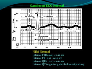 Nilai NormalNilai Normal
Interval P (Durasi) ≤ 0,12 secInterval P (Durasi) ≤ 0,12 sec
Interval PR : 0,12 - 0,20 secInterval PR : 0,12 - 0,20 sec
Interval QRS : 0,07 – 0,10 secInterval QRS : 0,07 – 0,10 sec
Interval QT tergantung dari frekwensi jantungInterval QT tergantung dari frekwensi jantung
Gambaran EKG Normal
 
