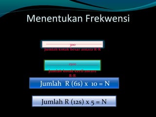 Menentukan Frekwensi
1500
Jumlah kotak kecil antara
R-R
300
Jumlah kotak besar antara R-R
Jumlah R (6s) x 10 = N
Jumlah R (12s) x 5 = N
 