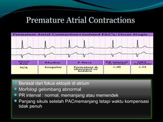 Premature Atrial Contractions
Berasal dari fokus ektopik di atrium
Morfologi gelombang abnormal
PR interval : normal, memanjang atau memendek
Panjang sikuls setelah PACmemanjang tetapi waktu kompensasi
tidak penuh
 