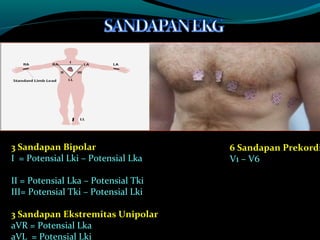3 Sandapan Bipolar
I = Potensial Lki – Potensial Lka
II = Potensial Lka – Potensial Tki
III= Potensial Tki – Potensial Lki
3 Sandapan Ekstremitas Unipolar
aVR = Potensial Lka
aVL = Potensial Lki
6 Sandapan Prekordi
V1 – V6
 
