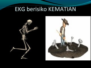 EKG berisiko KEMATIAN
 
