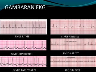 Ekg Drug Dan Defibrilator