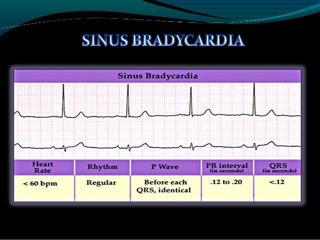 Ekg Drug Dan Defibrilator