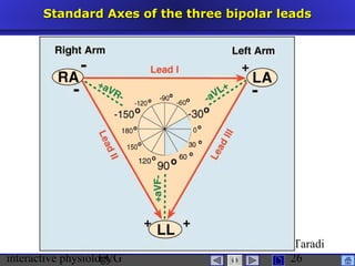 interactive physiologyECG
Taradi
26
Standard Axes of the three bipolar leadsStandard Axes of the three bipolar leads
 