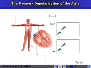 interactive physiologyECG
Taradi
32
The P wave - Depolarization of the AtriaThe P wave - Depolarization of the Atria
Lead I.
 
