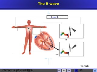 interactive physiologyECG
Taradi
35
The R waveThe R wave
Lead I.
 