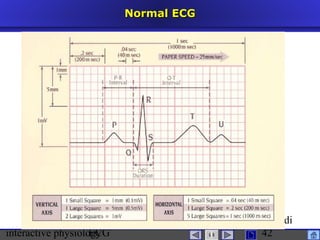 interactive physiologyECG
Taradi
42
Normal ECGNormal ECG
 