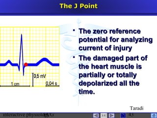 interactive physiologyECG
Taradi
43
The J PointThe J Point
 The zero referenceThe zero reference
potential for analyzingpotential for analyzing
current of injurycurrent of injury
 The damaged part ofThe damaged part of
the heart muscle isthe heart muscle is
partially or totallypartially or totally
depolarized all thedepolarized all the
time.time.
 