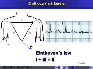interactive physiologyECG
Taradi
50
Einthoven´s triangleEinthoven´s triangle
Einthoven´s lawEinthoven´s law
I + III = III + III = II
 