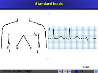 interactive physiologyECG
Taradi
51
Standard leadsStandard leads
 