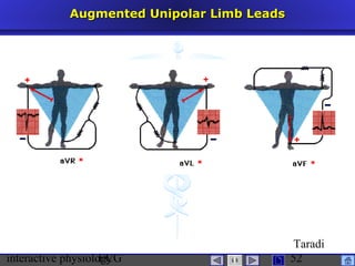 interactive physiologyECG
Taradi
52
Augmented Unipolar Limb LeadsAugmented Unipolar Limb Leads
 