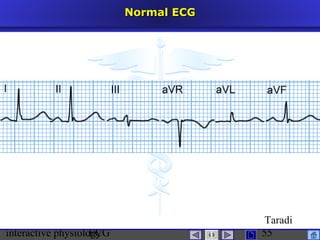 interactive physiologyECG
Taradi
55
Normal ECGNormal ECG
 