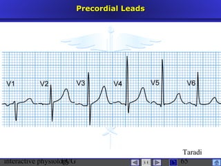 interactive physiologyECG
Taradi
65
Precordial LeadsPrecordial Leads
 