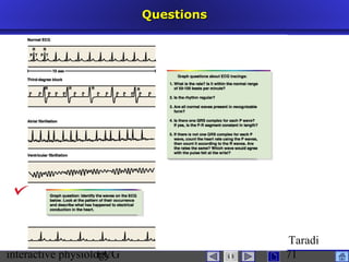 interactive physiologyECG
Taradi
71
QuestionsQuestions
 