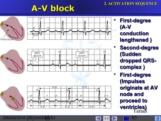 interactive physiologyECG
Taradi
85
A-V blockA-V block
 First-degreeFirst-degree
(A-V(A-V
conductionconduction
lengthened )lengthened )
 Second-degreeSecond-degree
(Sudden(Sudden
dropped QRS-dropped QRS-
complex )complex )
 First-degreeFirst-degree
(Impulses(Impulses
originate at AVoriginate at AV
node andnode and
proceed toproceed to
ventricles)ventricles)
2.2. ACTIVATION SEQUENCEACTIVATION SEQUENCE
 