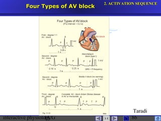 interactive physiologyECG
Taradi
86
Four Types of AV blockFour Types of AV block
2.2. ACTIVATION SEQUENCEACTIVATION SEQUENCE
 