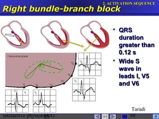 interactive physiologyECG
Taradi
88
Right bundle-branch blockRight bundle-branch block
2.2. ACTIVATION SEQUENCEACTIVATION SEQUENCE
 QRSQRS
durationduration
greater thangreater than
0.12 s0.12 s
 Wide SWide S
wave inwave in
leads I, V5leads I, V5
and V6and V6
 