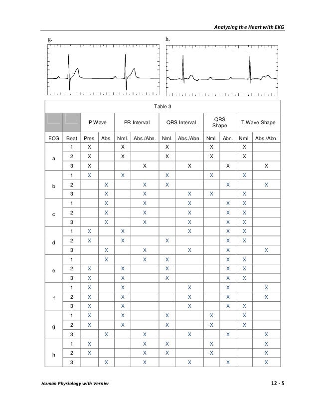 Ekg experiment 3