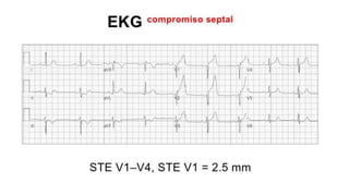 EKG FACIL.pdf