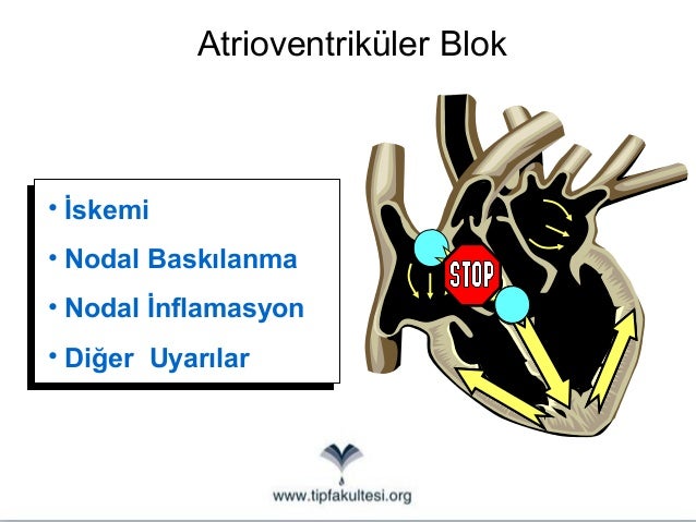 Bir çocuk için Rinofluimucil ne zaman reçete edilir 74