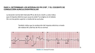Interpretación del ECG en ocho pasos _Huszar[1].pptx