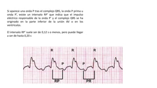 Interpretación del ECG en ocho pasos _Huszar[1].pptx