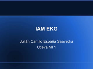 IAM EKG
Julián Camilo España Saavedra
Uceva MI 1
 